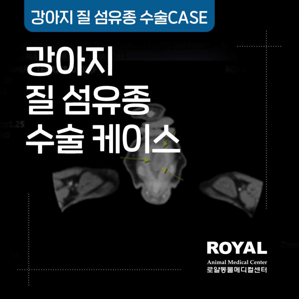 강아지 질 섬유종 수술 케이스_외과 김세훈 원장