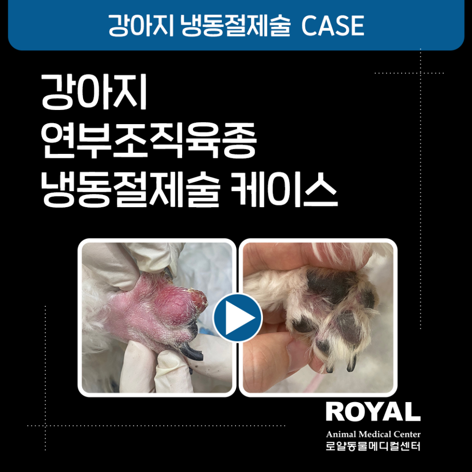 강아지 발가락 종양(연부조직육종) 냉동절제술 케이스